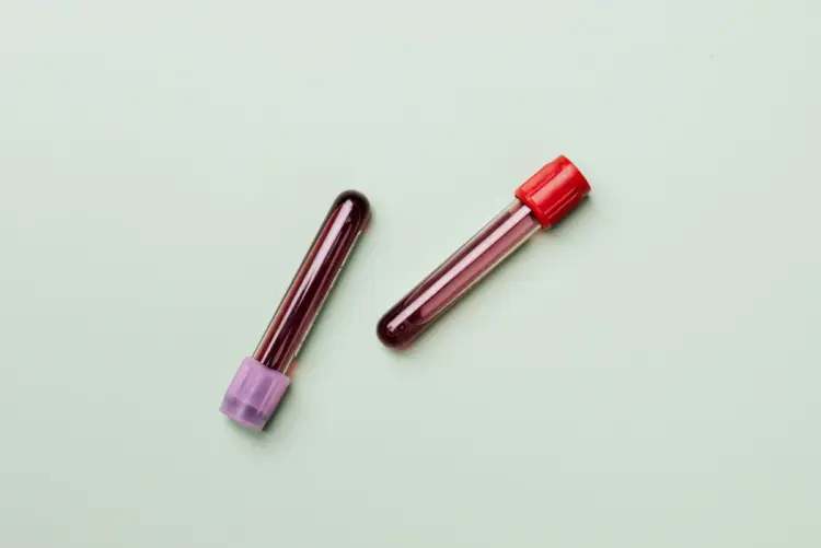 Blood sample tubes prepared for laboratory analysis
